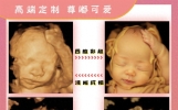 一张四维彩超图就能预测胎儿长相？专家：娱乐性大于准确性